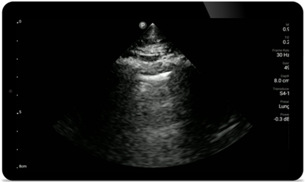 Pulmonary assessment