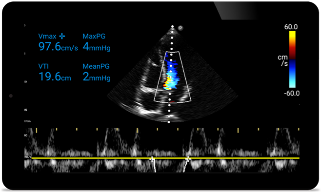 Act faster to protect their heart