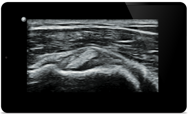 Start treatment with an accurate diagnosis