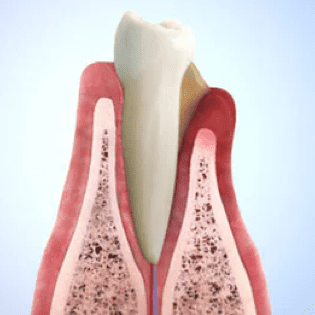 Philips Sonicare DiamondClean Smart