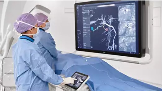 Smart ct